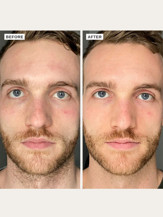 Alpha-H Vitamin B Serum før og efter resultat to