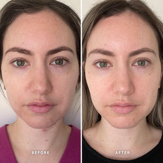 Alpha-H Vitamin B Serum før og efter resultat