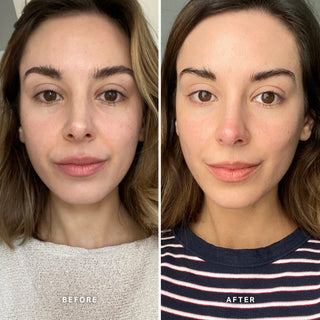 Alpha-H Vitamin C Serum før og efter resultat to
