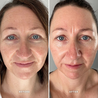 Alpha-H Vitamin E Serum før og efter resultat