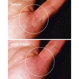 Murad Quick Relief Moisture Treatment før og efter