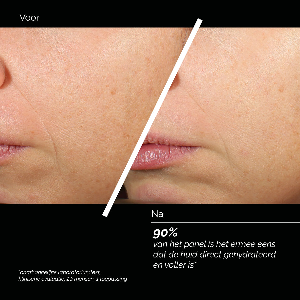Comfort Zone Skin Regimen Lx HA4 Jelly Serum før og efter