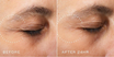 Medik8 Crystal Retinal Ceramide Eye 3 15ml effect