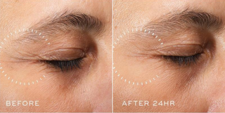 Medik8 Crystal Retinal Ceramide Eye 3 15ml effect